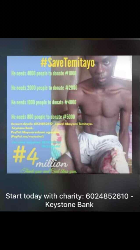 ICE_TEA911's tweet photo. @temitayo_Lawal_ 
Please help save temitayo,we are so scared,its growing and he's going weak day by day,please please please please 

A retweet or repost will go along way...God bless you. https://t.co/jSI0gR0kSw