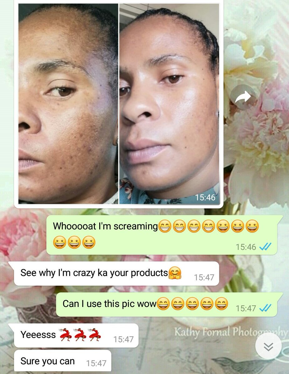 Lush_Beauty1's tweet photo. IFB, kindly retweet my hustle
Get rid of:
▶Pimples scars
▶Dull and dead skin
▶Blemishes
▶Toxins of your face
Get Polishing Peel for R300
📦Delivery R60 nationwide.
Whatsapp 📲0749777590
https://t.co/WMyIKowzz3 Lerato
#HowIKnowUbuntuIsDead
#SweetNightOST