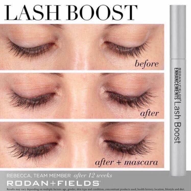 ShannonCol1201's tweet image. Why aren’t you using LASH BOOST yet?!  I can help you with that! 
#lashobsessed 🌟💫
#lashboost 
#rodanfields 
shanclaire1201.myrandf.com