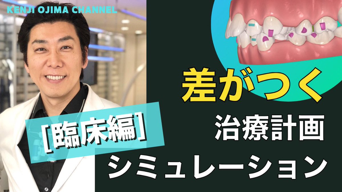 インビザラインはどこのクリニックでも同じシミュレーションにはなりません。
クリンチェックの違いについてまとめています
youtu.be/t6ZLRgD2rOQ
