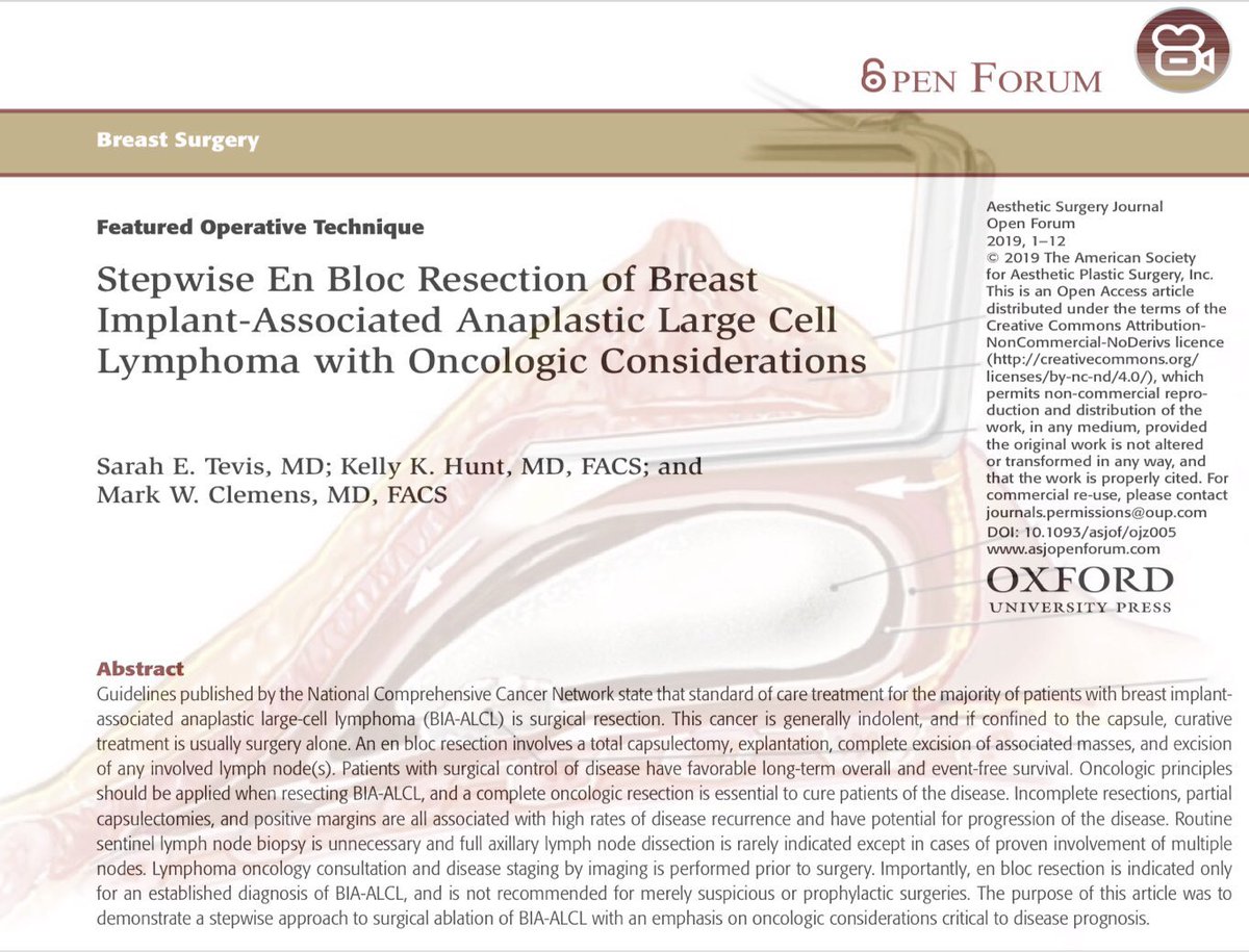 hunter_alexan's tweet photo. I spy “Stepwise En Bloc Resection of Breast Implant-Associated Anaplastic Large Cell Lymphoma with Oncologic Considerations” from ASJ Open Forum & a #TransparentAbstract created by @clemensmd. Read the full paper freely here: https://t.co/a5836ff7MB #plasticsurgery #ALCL #OA https://t.co/LElaIHR4W5