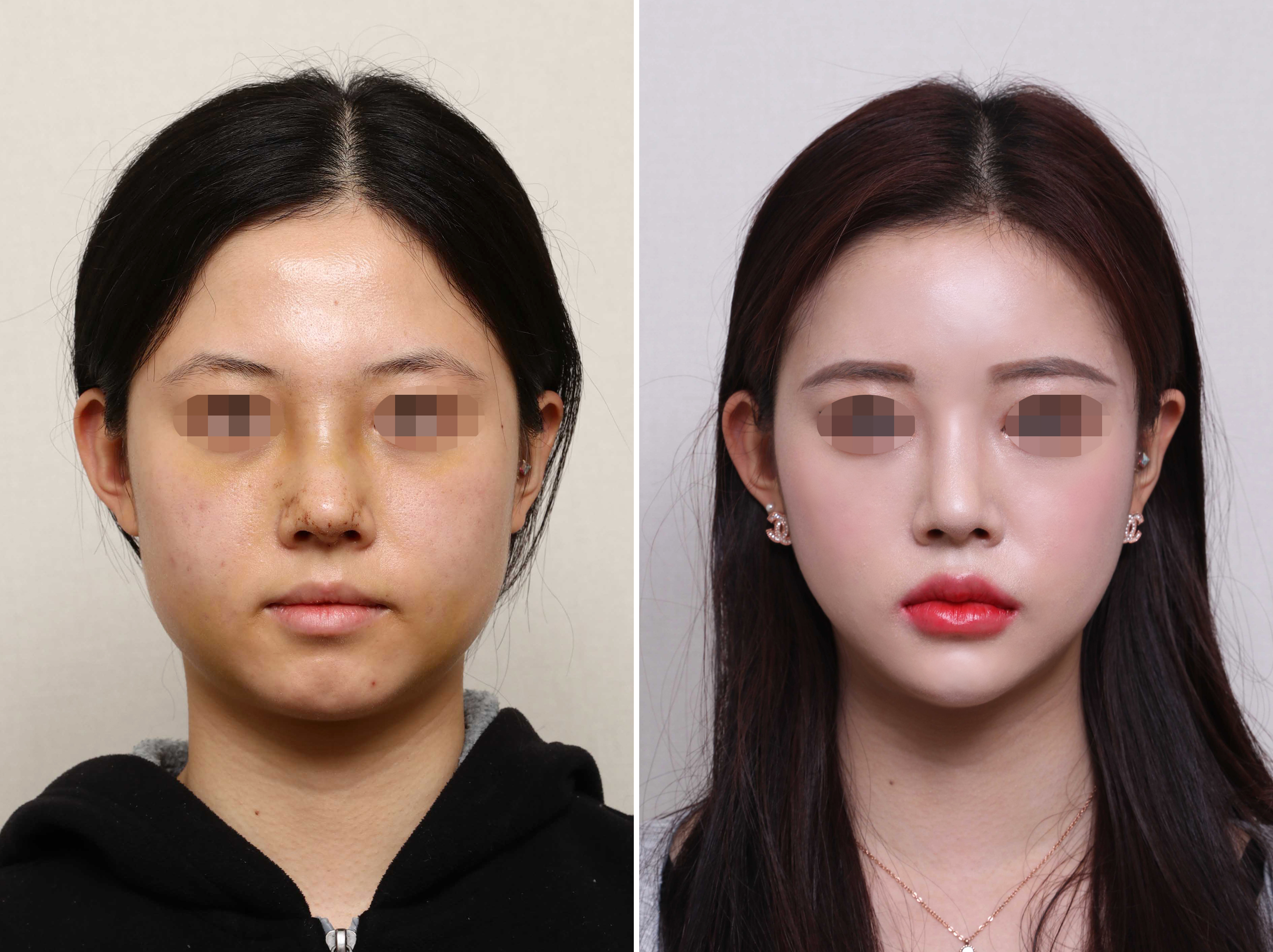 輪郭三点 Twitter Search Twitter