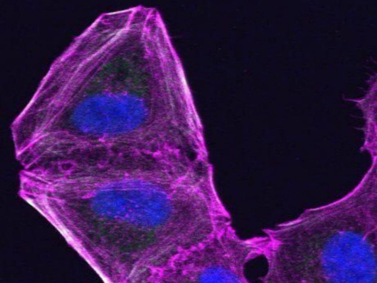 La_SER's tweet image. El equipo de Joan Massagué descifra el origen de las metástasis en el cáncer
cadenaser.com/ser/2020/01/15…