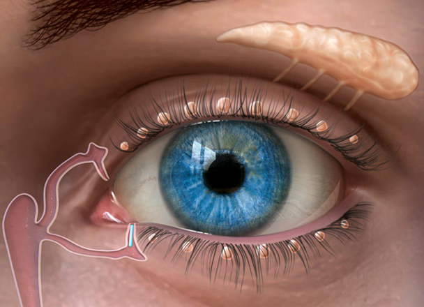 A #punctalplug is a small, sterile device that is inserted into the small openings (puncta) of the tear ducts. After these openings have been plugged, tears can no longer drain away from the eye through these ducts. #eyehealth #dryeye #specialist #optometrist #cheltenham