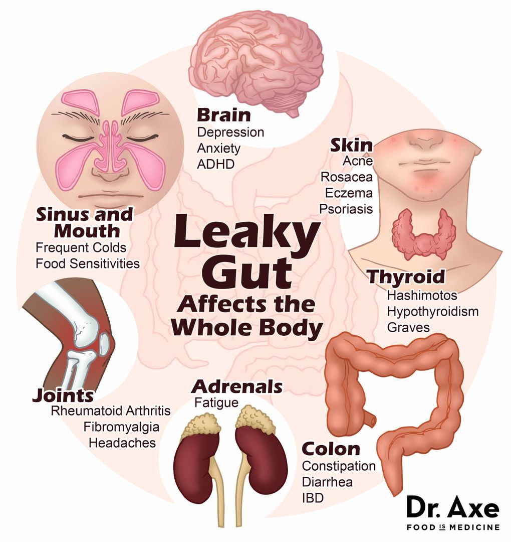 TheGutGeek's tweet photo. When we have leaky gut, more toxins pass from our gut into our body, which sets off inflammation + makes us feel like crap 😭Eating organic is one way to reduce our toxic load, as it comes without all those nasties like pesticides, herbicides, antibiotics, growth hormones 🤓🌿🐄 https://t.co/YDxLpjRPtq