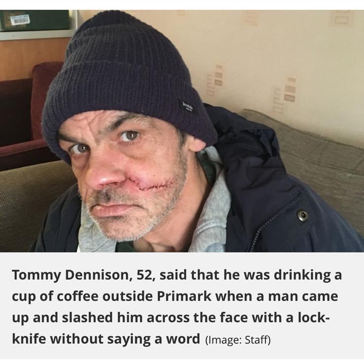 NishkamSWAT's tweet photo. It’s always sad to read about anyone being attacked but even more so when it's a vulnerable group of homeless people, we at NishkamSWAT take it personally.
Read the full article here:
https://t.co/sj6fJQ97mj
#waheguru #nishkamswat #homeless #homelessstabbing #homelessguy https://t.co/yaz8DKSLTf