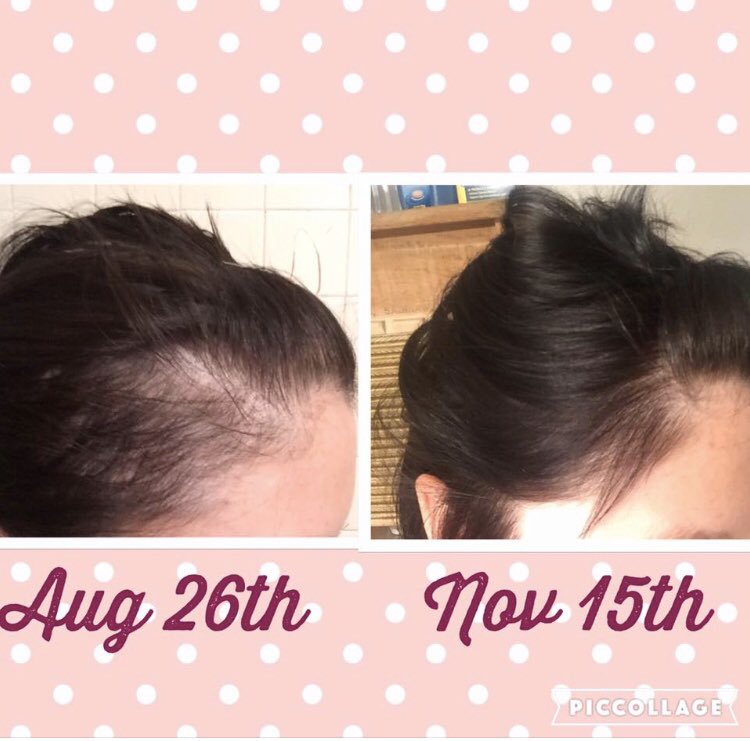 abryfor_monat's tweet photo. I just can’t get enough of how wonderful Monat products have worked for myself and clearly it has worked for others too, look at some of these before and afters photos! Hair doesn’t lie and neither do the results!! https://t.co/UH69MFqOI8