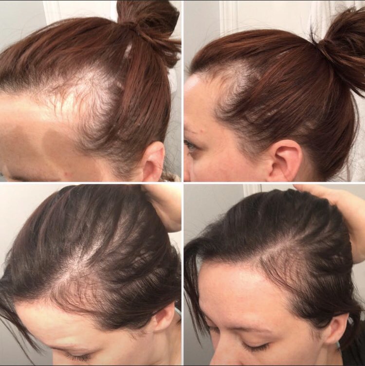 abryfor_monat's tweet photo. I just can’t get enough of how wonderful Monat products have worked for myself and clearly it has worked for others too, look at some of these before and afters photos! Hair doesn’t lie and neither do the results!! https://t.co/UH69MFqOI8