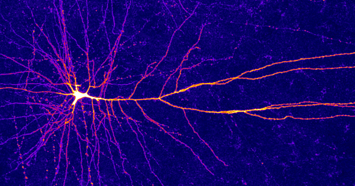 QuantaMagazine's tweet photo. The dendrite “arms” of some cortical neurons can perform a logic operation — exclusive OR — that once seemed to require a network of entire neurons. Here’s how that changes fundamental models in neuroscience: https://t.co/U3zcyHTYBE https://t.co/FhLfGcKLmW