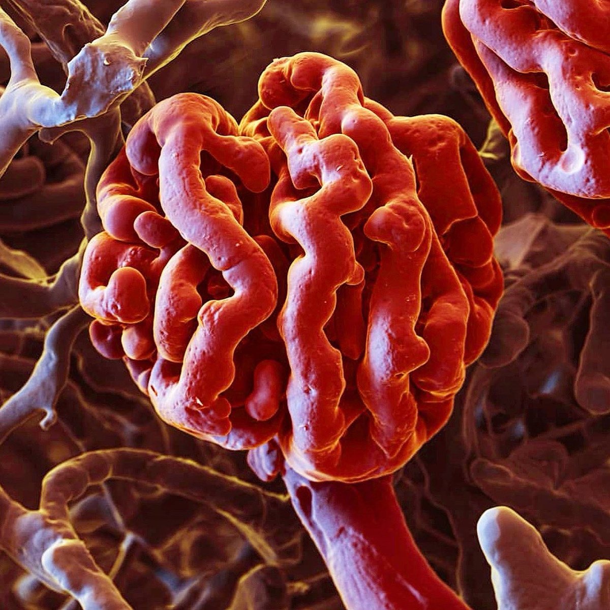 MEDspirationNFP's tweet photo. What you see here is a resin-cast specimen of the finest blood vessels, in the human body, the nephron! Magnification: app. 1500x (at 15x12cm image size). Learn more about this magnificent structure by reading today’s post⤵️
https://t.co/GwYlK6aEy9
#MEDspiration https://t.co/4dWYLi229H