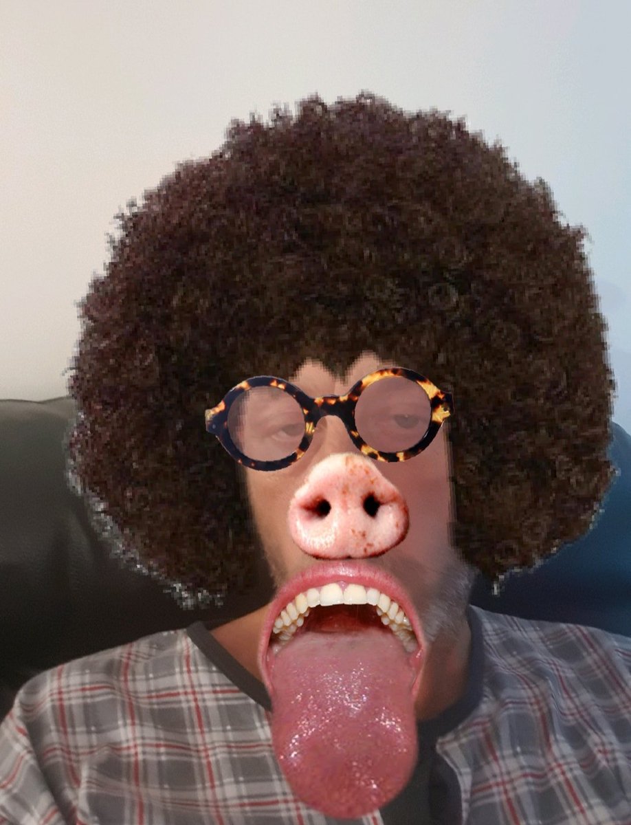 PThompson40's tweet image. Wft why did i go to see Katie price's plastic surgeon