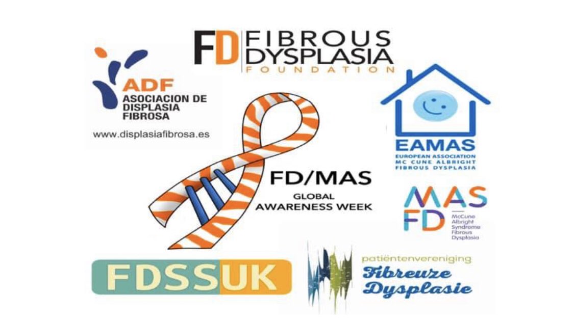 AnnaliesaAngel's tweet photo. So this is happening. #FibrousDysplasia #FDWarrior #RareDiseaseAwareness https://t.co/5DtbTEaDg6