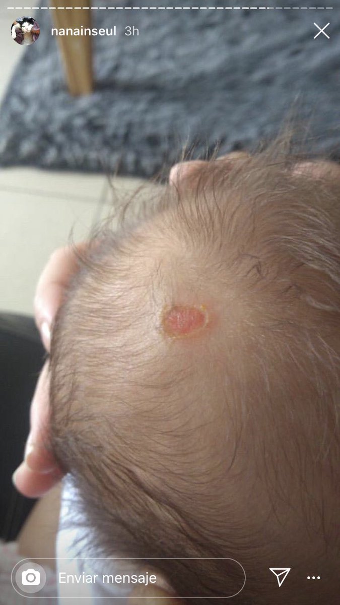 vitubuhh's tweet photo. Tome estas capturas del Instagram de nanainseul, porque me parece súper importante para tomar conciencia, porque a veces no nos damos cuenta de la gravedad y las consecuencias que pueden tener nuestras acciones. https://t.co/LRESiSNylA