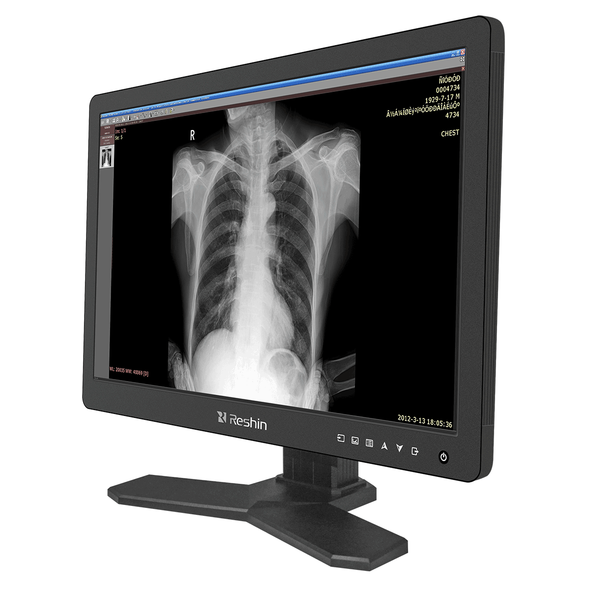 jlddisplay's tweet image. Shenzhen JLD Display Expert Co., Ltd aims for excellence in every aspect of production. We only offer high-quality products. #diagnosticdisplay #surgicaldisplays #2megapixelmonitor