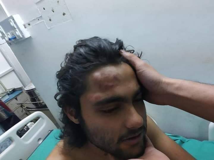 faizan0008's tweet photo. After Jamia, AMU and JNU, Students of Visva Bharati University, Shantiniketan, West Besgal brutally attacked by ABVP Terrorists.
#BanABVP
@IndiasMuslims https://t.co/XoX5ghAnC9