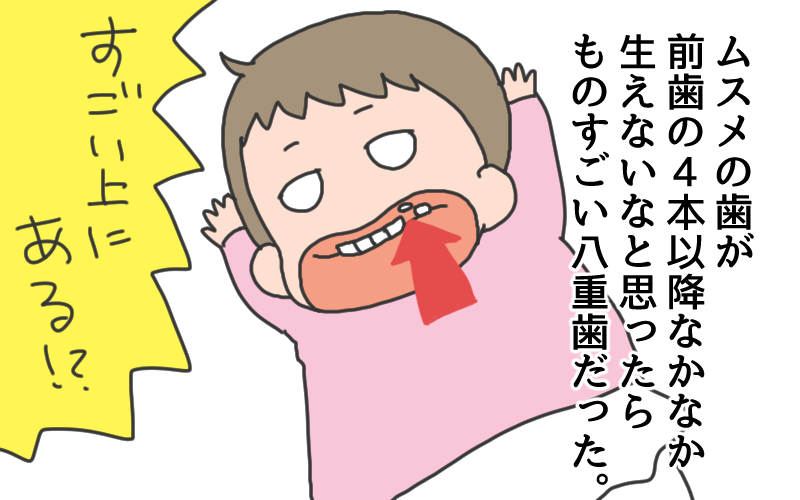 八重歯ってこのままにしておいていいのかな…?
#いそがしくてもメモ 