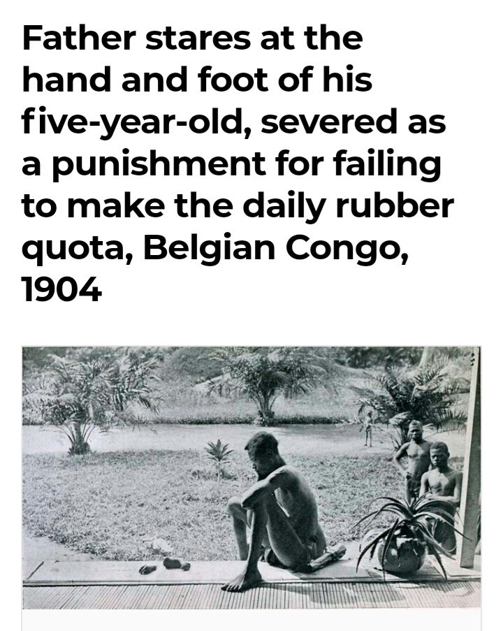 13. Apa yang akan terjadi jika kamu gagal memenuhi kuota karet harian di Kongo Belgia?Kamu akan dapat "hadiah".Skrinsut dari rarehistoricalphotos[.]com