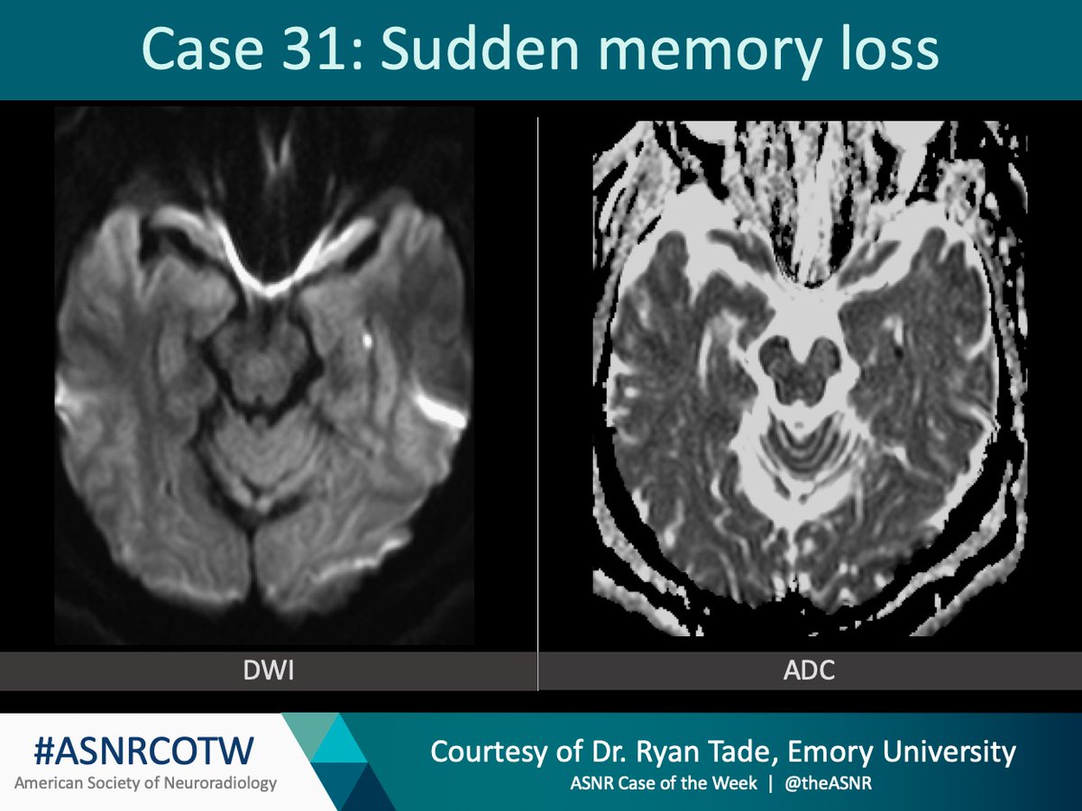 The American Society of Neuroradiology tweet media