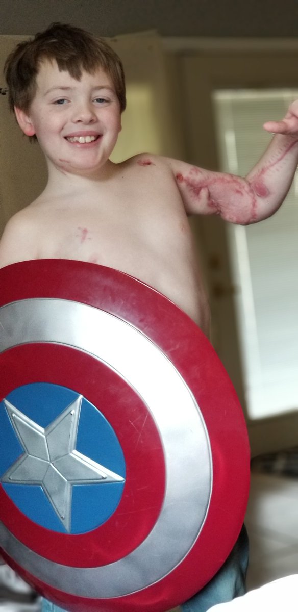 nessleigh2109's tweet photo. Probably won't happen but my son Austyn is a huge @ChrisEvans fan and of course his favorite Avenger is @CaptainAmerica He was attacked by a family dog in October and had to have 13 surgeries to save his arm, 3 of those were to save his life. Can we give my boy a shout out please https://t.co/WYshlBDmQL