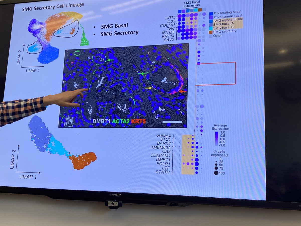 KaminskiMed's tweet photo. Seibold: We identified a population of myoepithelial cells that we think serves as a progenitor cells for submucosal glands secretory cells. Really cool #YaleGreatTalks #scRNASseq #LungCellAtlas https://t.co/m9ZBUrU3td