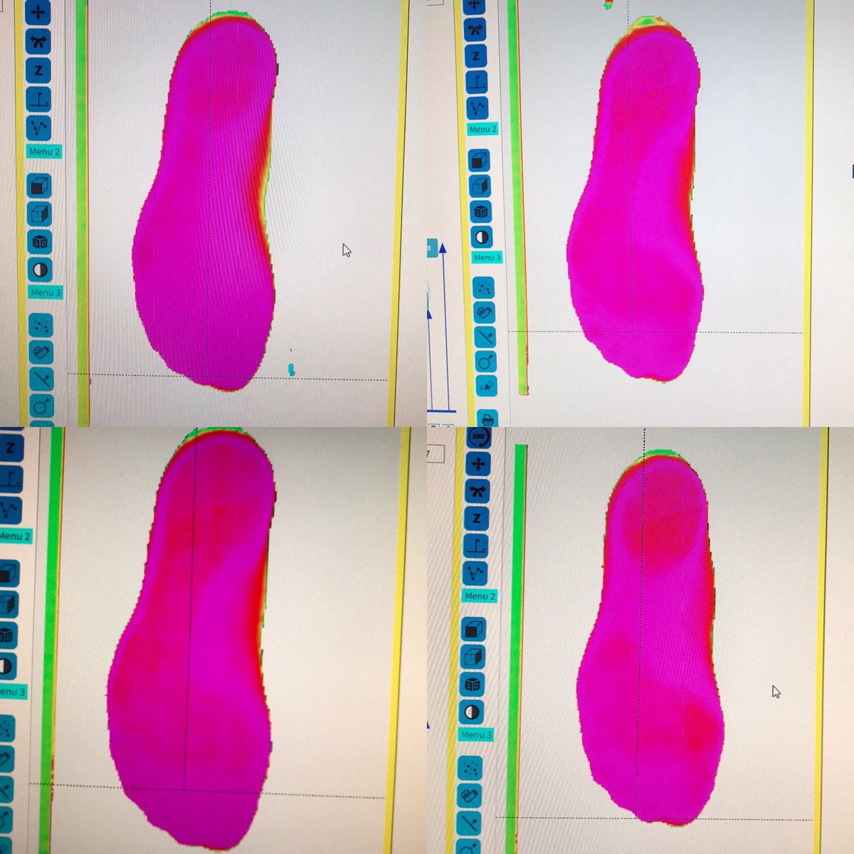 These are all scans of the same foot, in different positions. I know what position to scan your foot in to get the best foot orthoses. #orthotics #cardiff #howdoesthatwork #pronationisnottheenemy