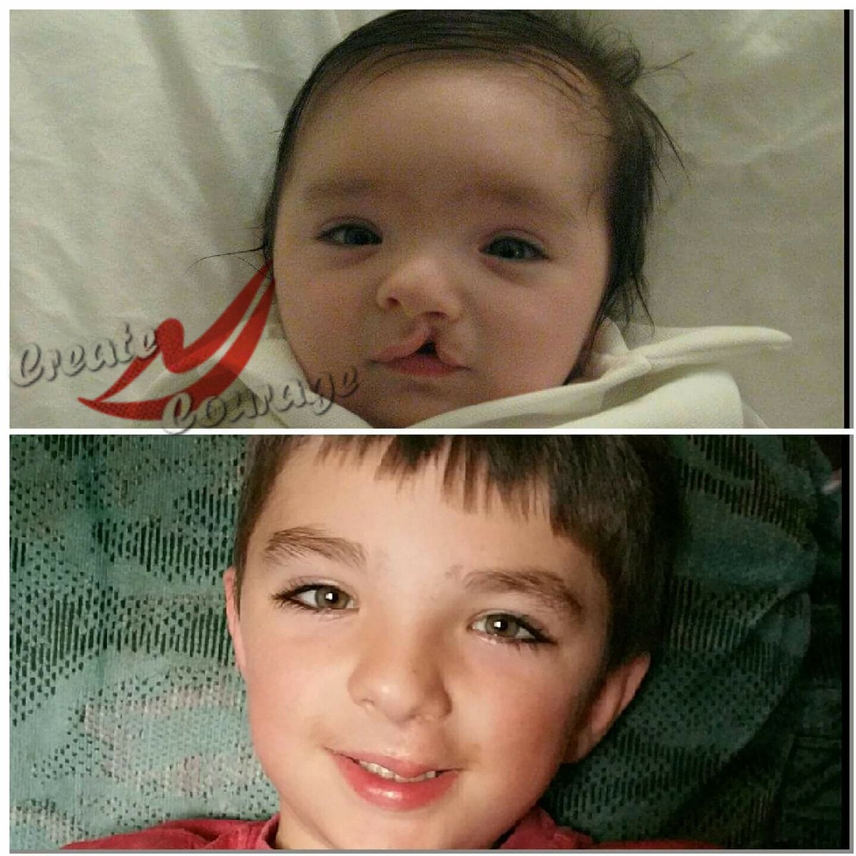 Cleftbook's tweet photo. @cher Thank you for your support and bringing awareness https://t.co/JpAA6MmMdj