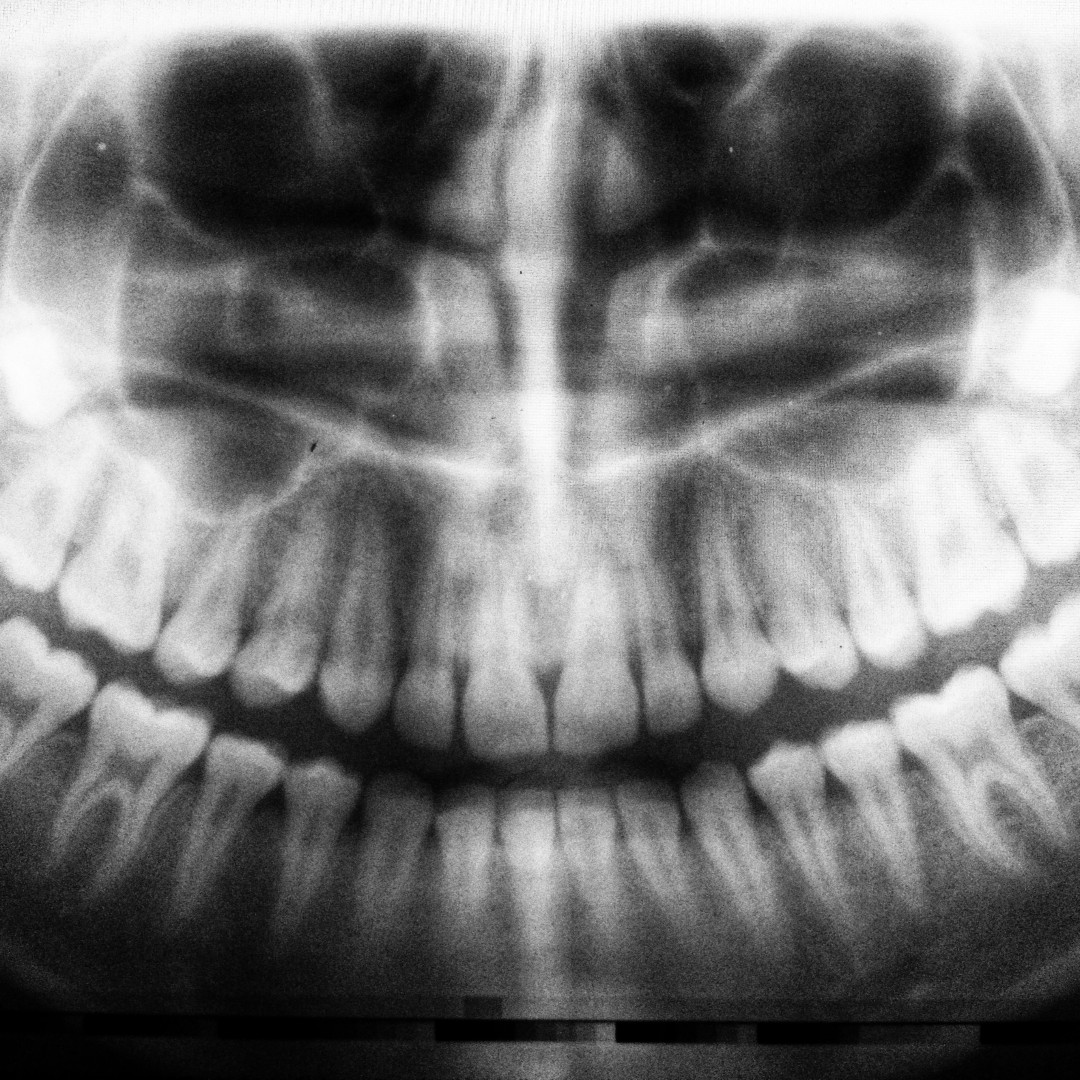 EACH TOOTH tells a story about its owner—about diet, lifestyle, and overall well-being. Many chronic health issues can be detected early with regular dental checkups! Schedule your next appointment today!

valleycreekdentalcare.com