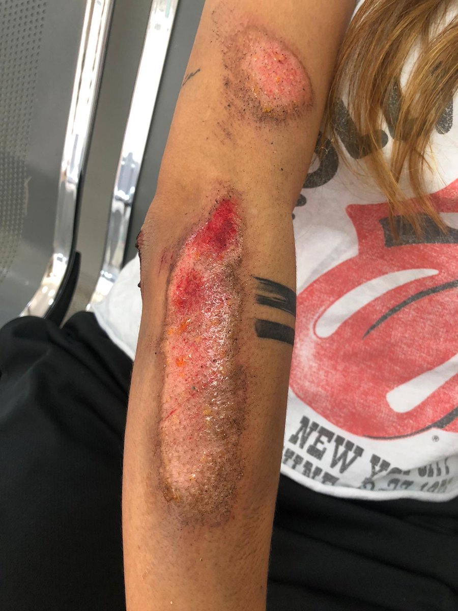 eliecerofficial's tweet image. El Domingo 12 de enero, me caí de la moto  con mi novio en la carrera 27A, arriba de la guardería mañanitas.
No hay policías acostados pintados, hay aproximadamente 5 y ninguno está pintado @MovilidadEnv @AlcaldiaEnv