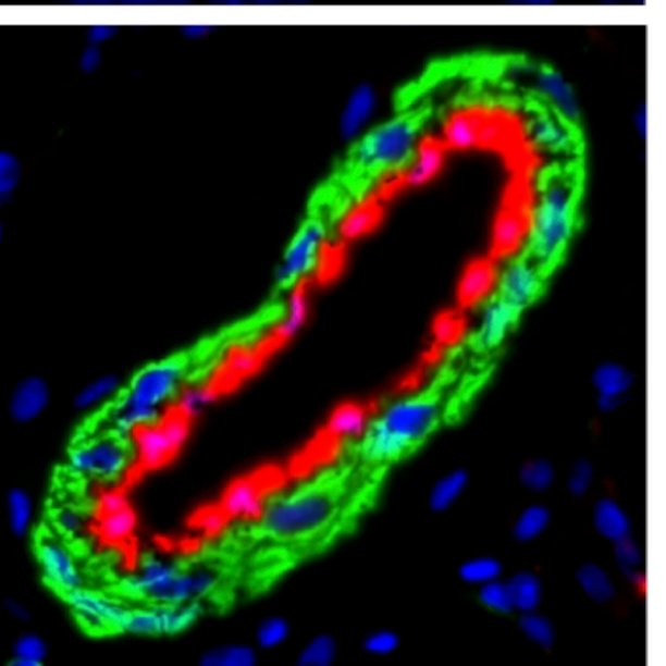 AJPCellPhys's tweet photo. #ImageOfTheWeek: From “Structural and Functional Definition of the #Pulmonary Vein System in a Chronic #Hypoxia-induced Pulmonary Hypertension Rat Model”. Pulmonary artery of hypoxic rat lung stained for SMA (green) and vWF (red). https://t.co/0foeWUiO4R
#PublishedinAJPCell https://t.co/NrHFiHA6SI