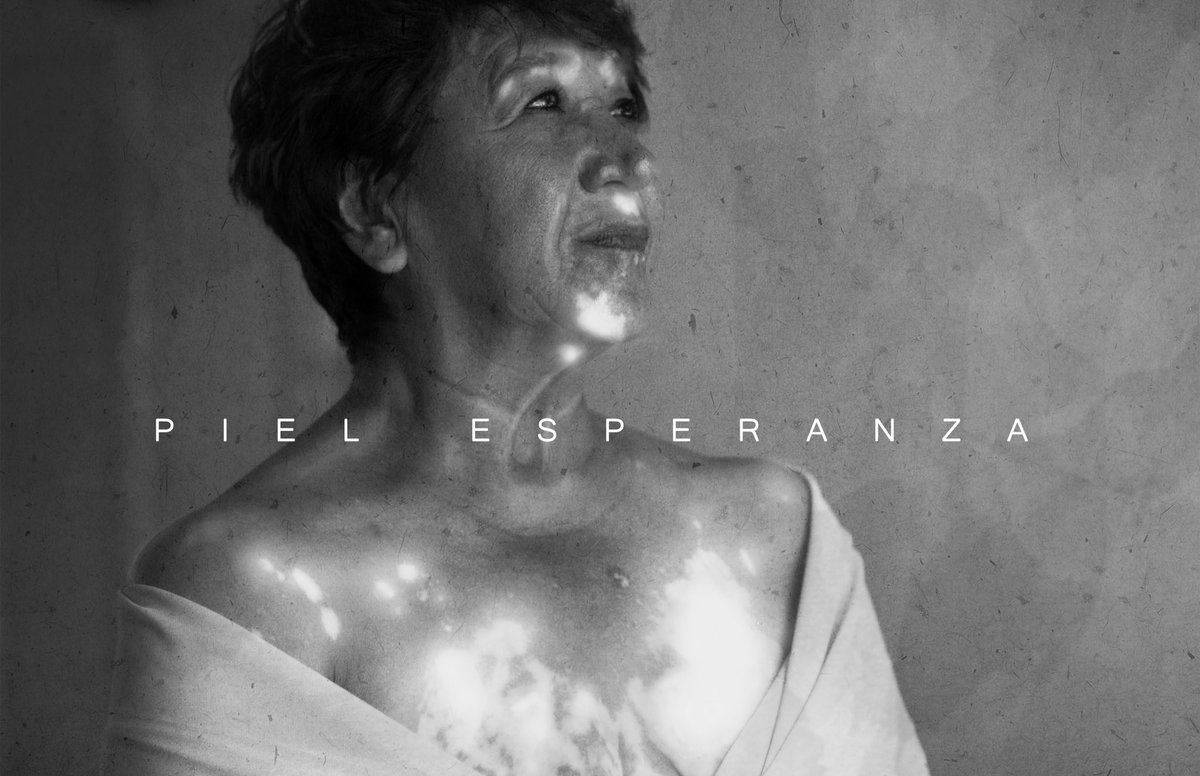 fan_nekobasu's tweet photo. Aquí, algunas de las fotografías que con mucho amor realicé a mi mamá.
“Piel onírica" es un estudio sobre el vitiligo, para demostrarle a ella (y a la gente que tiene esta condición) que es eternamente hermosa. https://t.co/qGTDKMOE12
