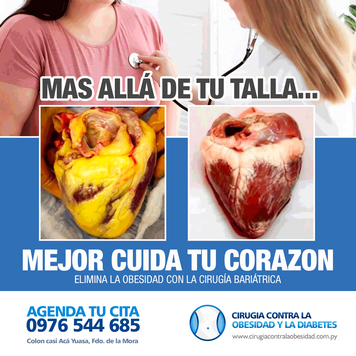 Bariatricapy's tweet photo. CAMBIA TU VIDA CON LA CIRUGÍA BARIÁTRICA. Estamos en: 📍https://t.co/lCdVWbNLDB - 📲AGENDA TU CITA (0976) 544 685 #CirugiaBariatrica #VivirSinObesidad #VivirSano #VivirSinDiabetes https://t.co/qD55qLHfAI