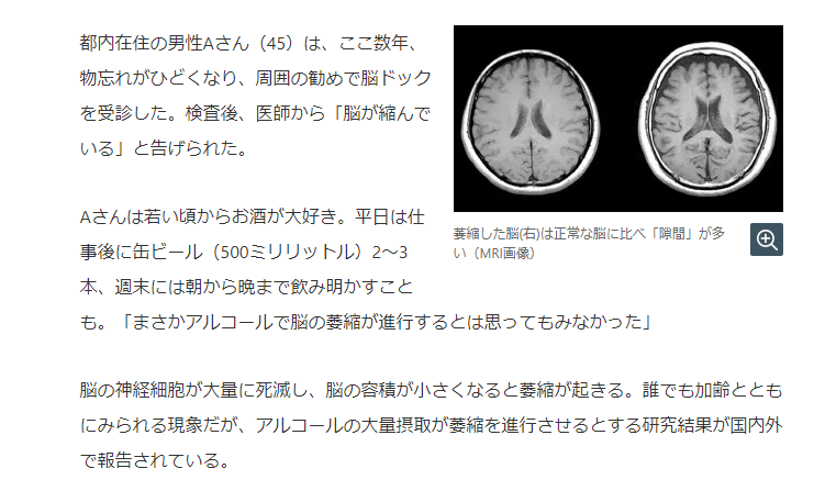 K A G R A 高速デイトレード 株 暗号通貨 酒の際は少しでも脳細胞を守るために海苔や枝豆 葉酸サプリを摂りましょう ノ W 葉酸は アルツハイマー型認知症だけでなく 脳血管にも働くことから脳血管性の認知症も予防できる 日本人は妊婦じゃなく