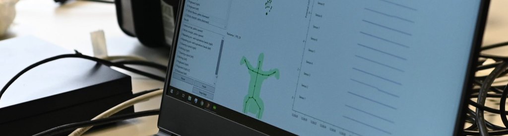 By analyzing 26 subjects, ZiuZ and UMCG obtained data that will provide new insight into the possibilities of distinguishing three rare movement disorders. By doing so, we’re able to provide patients with the medical care they need.

Full article: ziuz.com/news/nemo-movi…