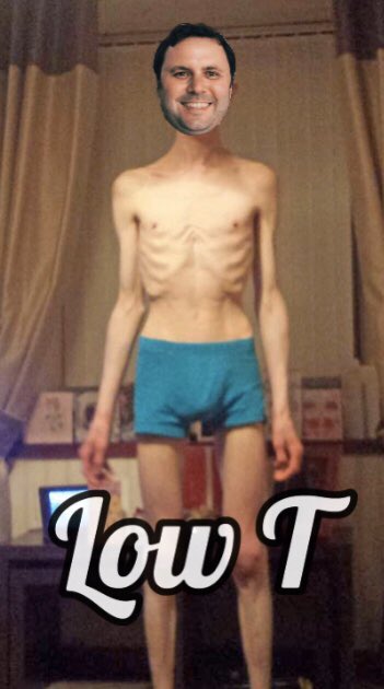 TheSoychild's tweet photo. @topsoyboy There is something wrong with his endocrine system.
LOW TESTOSTERONE.
#JDAINVENTED #soy https://t.co/Yni9PXLd4a