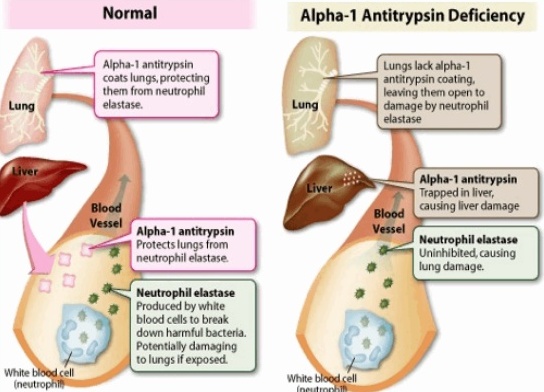 Alpha 1 Antitrypsin Stool - Stools Item Alpha 1 Antitrypsin Stool - Stools Item