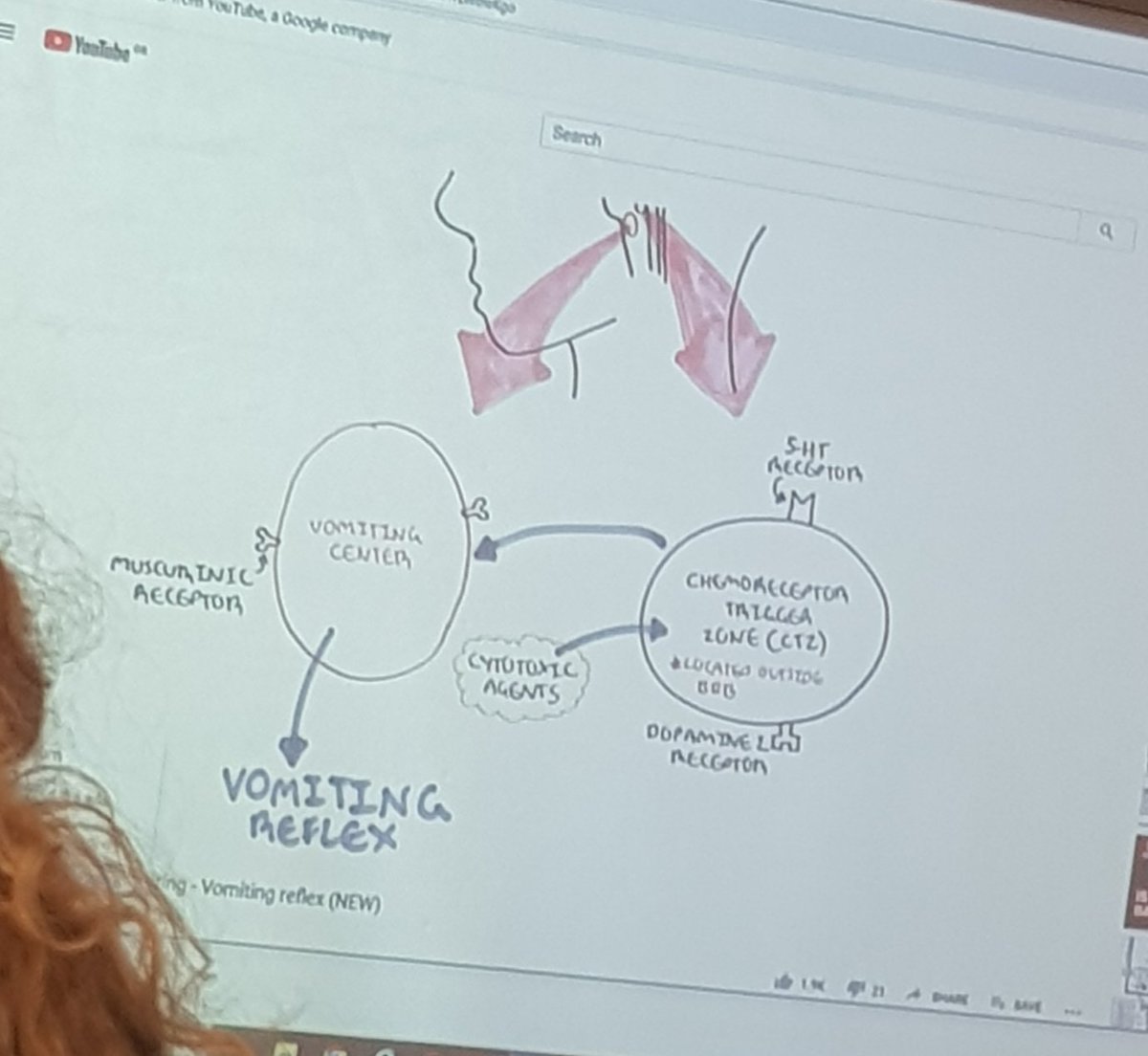 AngelinaC280522's tweet photo. Learning  about vomiting and nausea this morning. What a start to the day 😁. #nrs501, #pathophysiology #unilife https://t.co/zIKpPxmun6