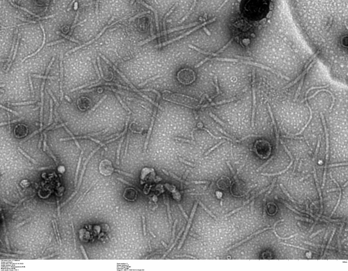 INRAE_France's tweet photo. #RP_INRAE Une possible alternative aux antibiotiques cachée dans le microbiote ? Des chercheurs d’INRAE (@INRAE_IDF @INRAE_DPT_MICA ) viennent de montrer le caractère très infectieux d’un virus bactérien du microbiote qui pourrait servir en phagothérapie : https://t.co/lsIABrtBRA https://t.co/ea3do6EOIC