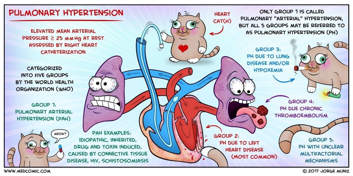 AltavantScience's tweet photo. TY Jorge Muniz for this #Medcomic on #Pulmonaryhypertension. #PH refers to increased pressure in pulmonary circulation. It develops when pulmonary vessels become constricted and/or obstructed, which can occur in a wide variety of conditions. https://t.co/K4IY02JSQD via @YNHallak