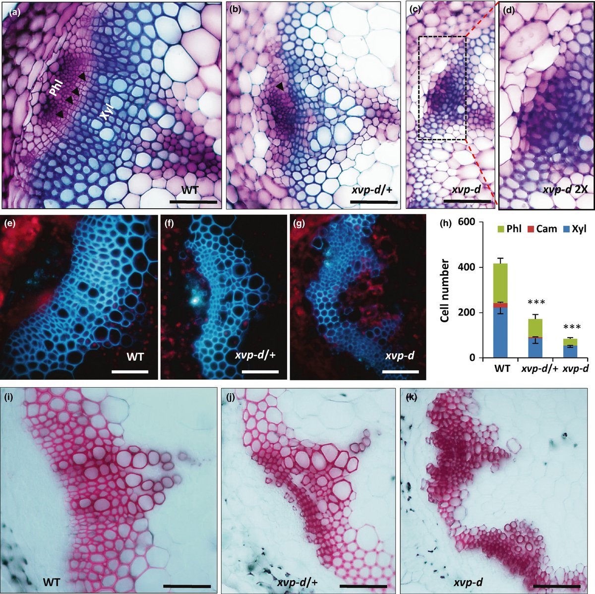 Vascular patterning and xylem differentiation of the xvp‐d mutant in Arabidopsis. 