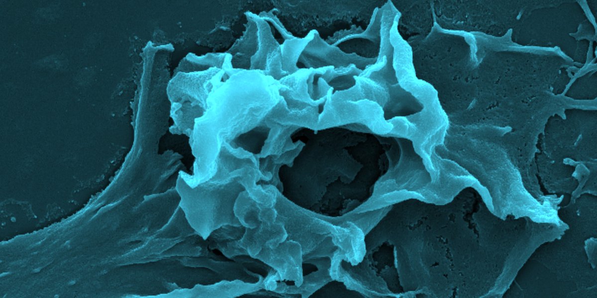 RoyalMicroSoc's tweet image. The Midlands SEM Users Meeting (MIDSEM) returns for 2020! This year it will be held on Wednesday 22nd April and will take place in Birmingham. If you are interested in attending or booking a trade stand, please liase with Paul on p.f.stanley@bham.ac.uk