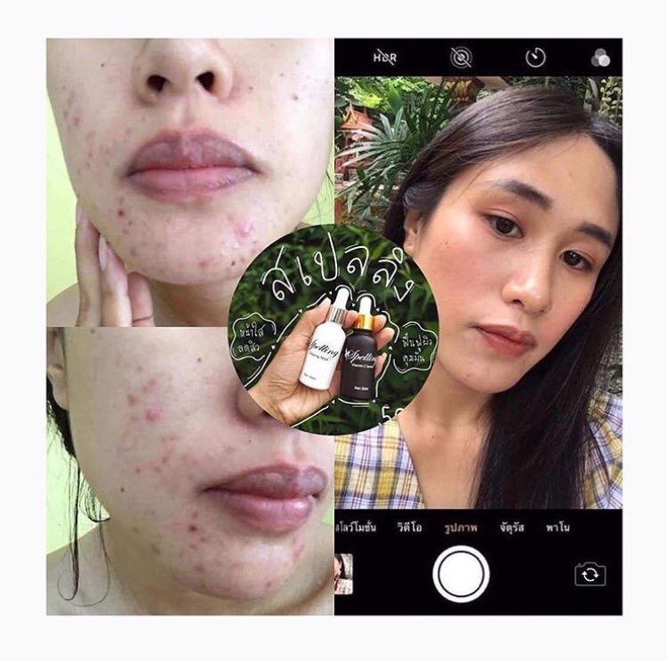 fernshop_kn's tweet photo. 😍ขออนุญาตรีวิวจากผู้ใช้ค่ะ😍 ใช้ของจริงเท่านั้น ของปลอมทำไม่ได้จ้า ของปลอมพังอย่างเดียว!!!

➡️ใช้ก่อน หน้าใสก่อนจ้า⬅️

#spelling #เซรั่มวิตซี #สลิปปิ้งมาร์ก
#SpellingVitC #ลดสิว #สิว #สเปลลิ่ง https://t.co/OVfcQgrnWJ