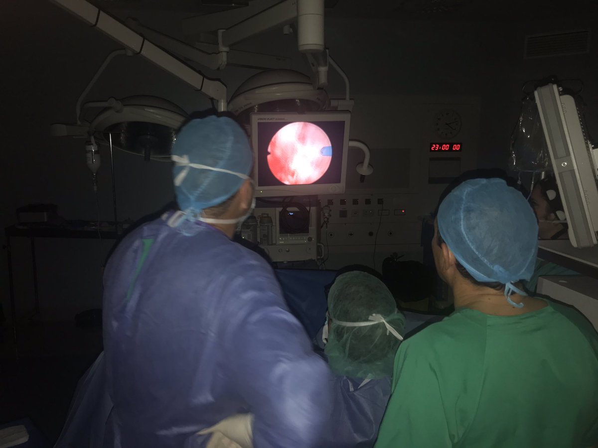 enrique_rijo's tweet photo. Holmium laser enucleation of the prostate #HoLEP Live surgeries in Sevilla #RichardWolf #MegaPulse70+ @RichardWolfUK https://t.co/m5KOc5TWpX