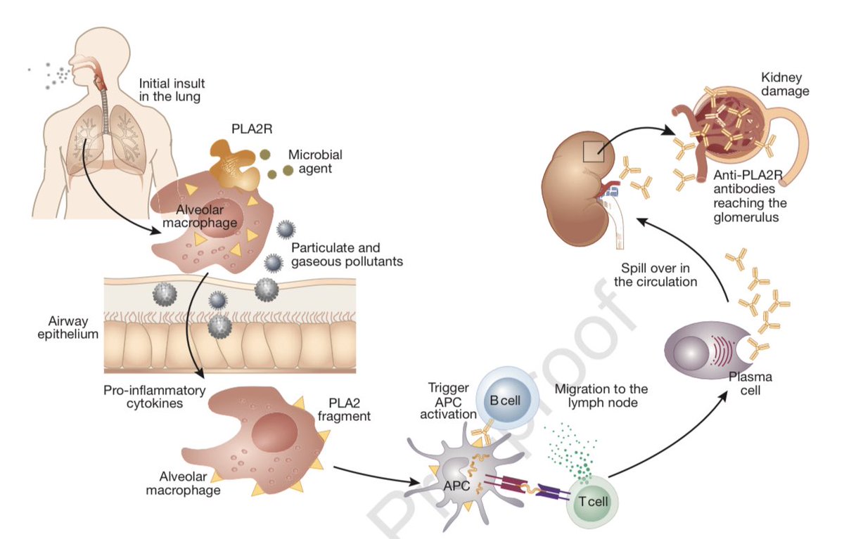 Cetosis diabetica proceso fisiológico