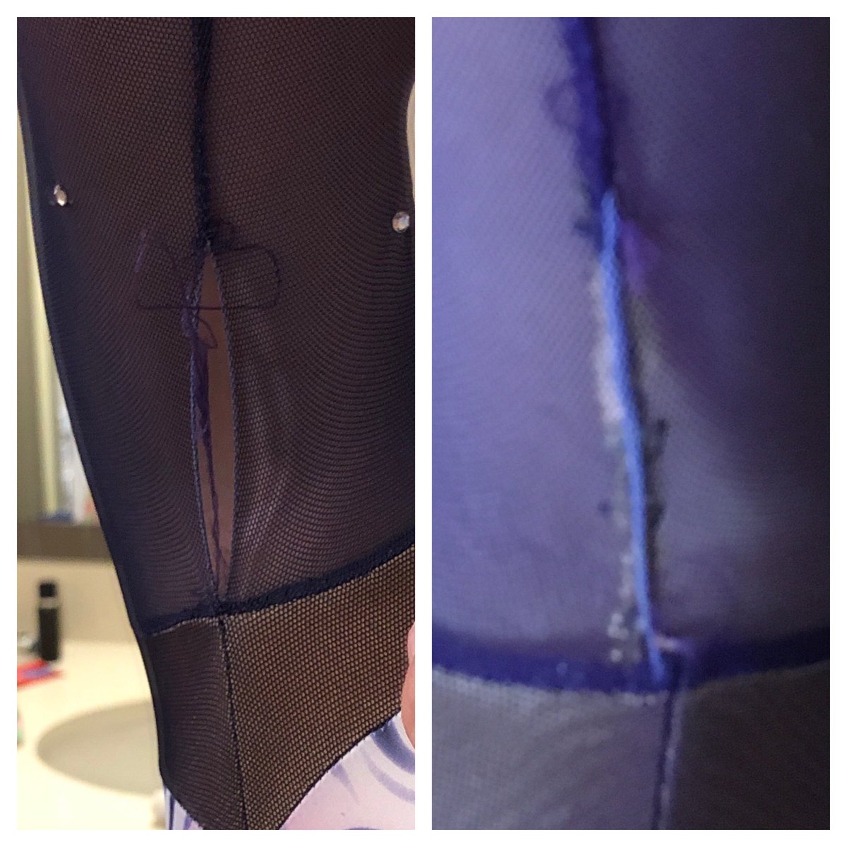 BritFltdoc's tweet photo. Acute leotard dehiscence 30 mins prior to competition for my daughter. 6 horizontal mattress sutures and some nail polish and it’s been resuscitated. Let’s Go! #MacGyvertime #EM #Makingdo #usagymnastics ⁦@phenomenaldocs⁩ https://t.co/ApP26S4Lku