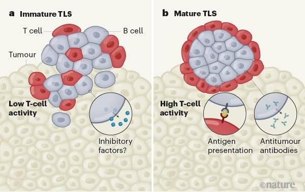 3 estudios revelan que la presencia en tumores de 2 componentes inmunes clave (células B y estructuras linfoides terciarias) se asocia con resultados favorables cuando las personas se someten a #inmunoterapia. Información a través de @nresearchnews en: 🔎 go.nature.com/2NBUbbz
