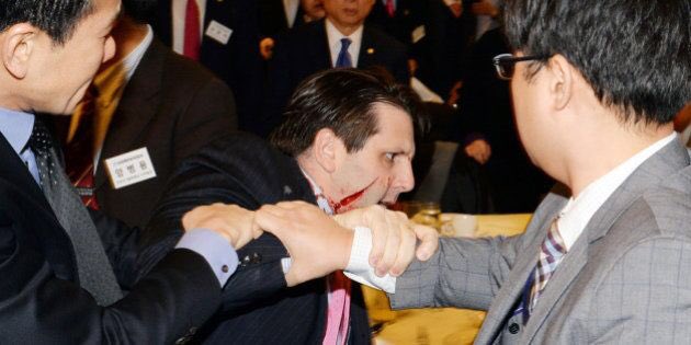 tickle_tickle24's tweet photo. @BBCWorld Five years ago, US ambassador was cut off face by Korean
remind of me this accident #リッパート駐韓大使襲撃事件 again
It's not reason Japanease family roots.
Look #MarkLippert US ambassador face.
Hope #HarryHarris be safe
#koreanway #koreanstyle
Harassment of #USambassador https://t.co/2LtOTq0YUI