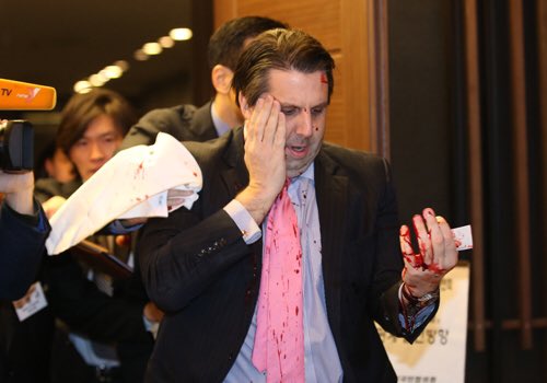 tickle_tickle24's tweet photo. @hoshusokuhou 5年前にも襲撃事件有り
Five years ago, US ambassador was cut off face by Korean
#リッパート駐韓大使襲撃事件
It's not only reason Japanease family roots. Look #MarkLippert ex US ambassador in KOREA.
Hope #HarryHarris be safe
#koreanway #koreanstyle
Harassment of #USambassador https://t.co/bmEZzU8nA7