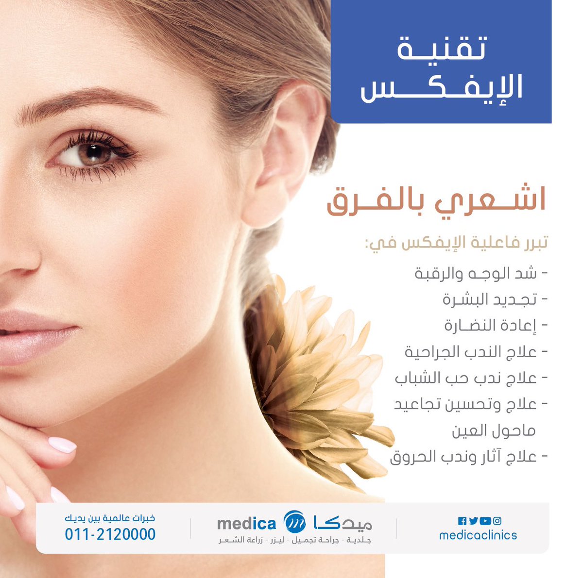 #تقنية_الايفكس_العالمية 👇