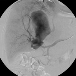 AppliedRadiology tweet media