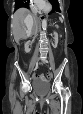 AppliedRadiology tweet media